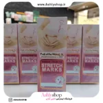 کرم رفع ترک پوست وکالی