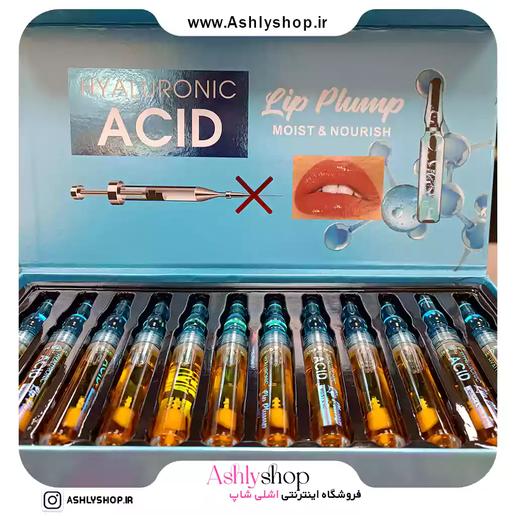 حجم‌دهنده لب هیالورونیک اسید کیس‌بیوتی