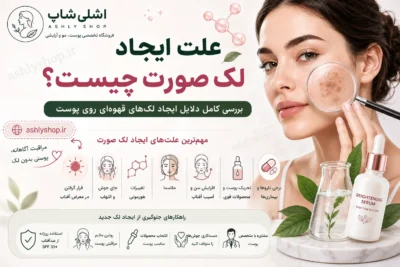 علت ایجاد لک صورت چیست؟ بررسی کامل دلایل ایجاد لک‌های قهوه‌ای روی پوست